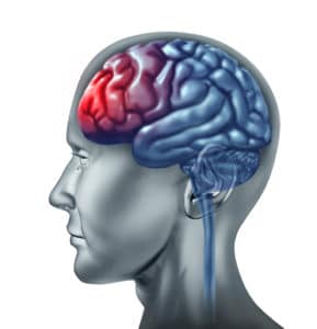 traumatic brain injury lawyers boston